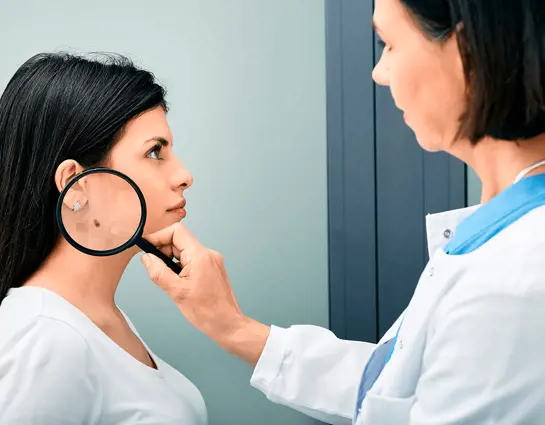 A dermatologist examines the patient's mole with a magnifying glass