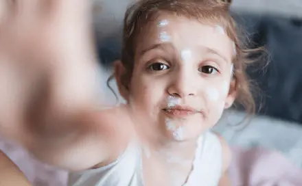 A girl with chicken pox