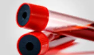 שירותי מעבדה בבית