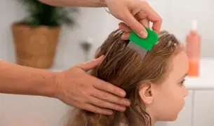 סירוק כינים